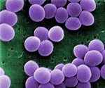 محققان مواد آنتی باکتریال جدیدی را برای پانسمان زخم ایجاد کردند